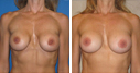 Before & After Photos